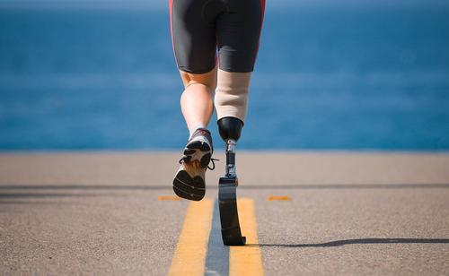 小腿假肢康复训练